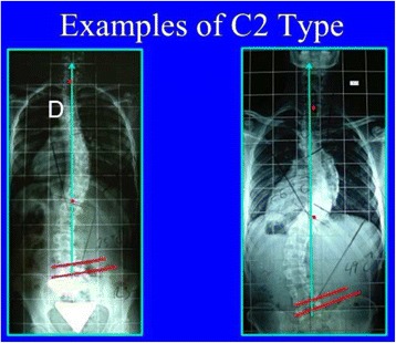 Fig. 34