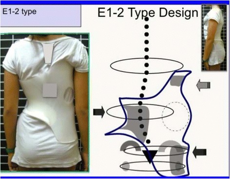 Fig. 51