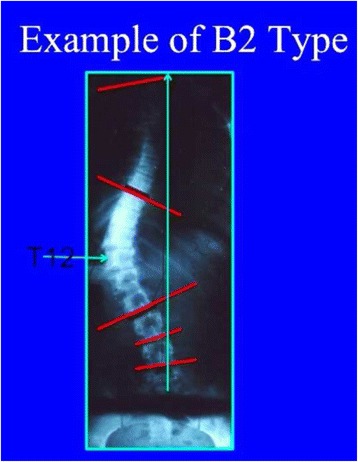 Fig. 30