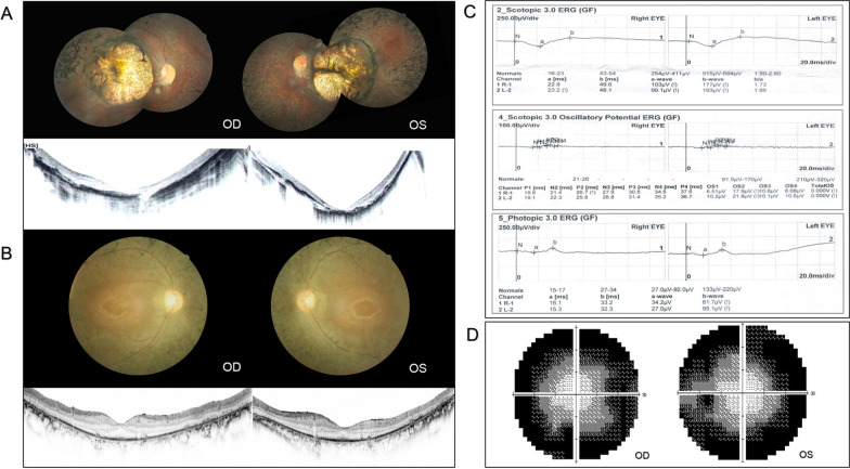 Fig. 1