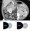 Fig. 2