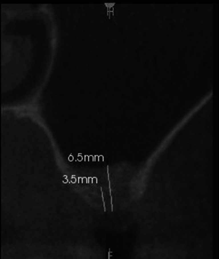 Fig. 3