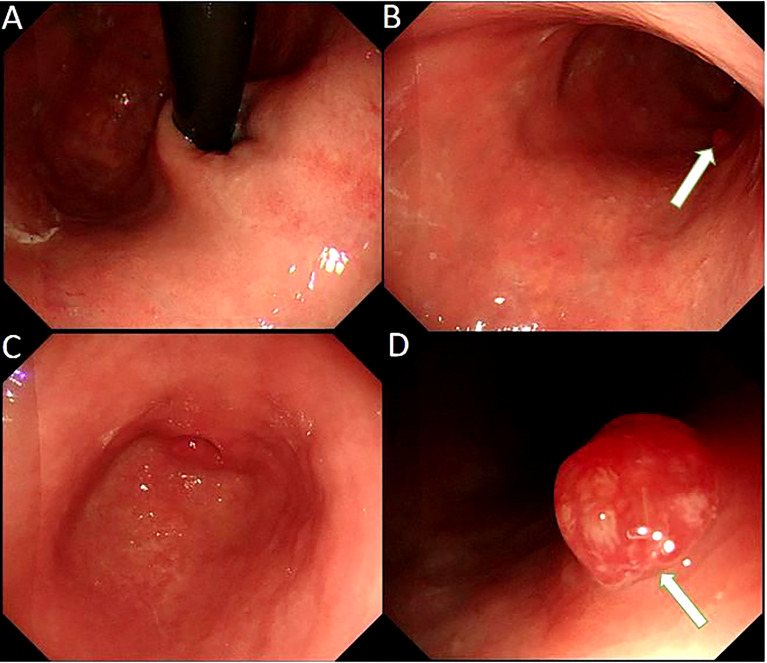 Figure 2