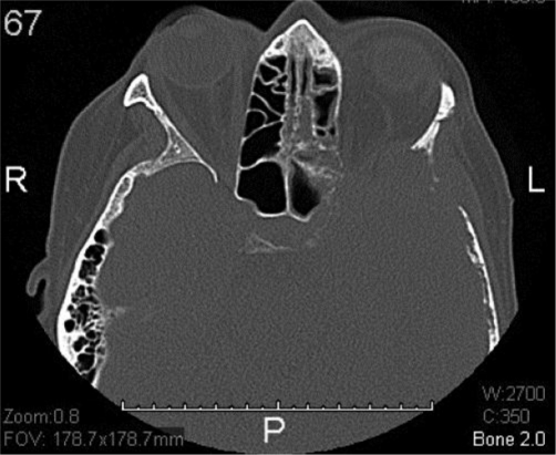 Fig. 4