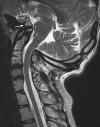 Fig. 39