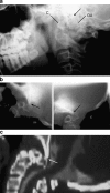 Fig. 31