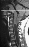 Fig. 42