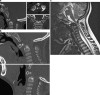 Fig. 33