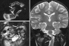 Fig. 48