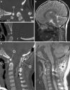 Fig. 29
