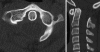 Fig. 54