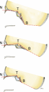 Fig. 37