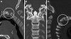 Fig. 49