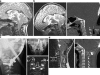 Fig. 44