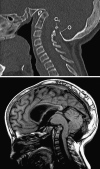 Fig. 41