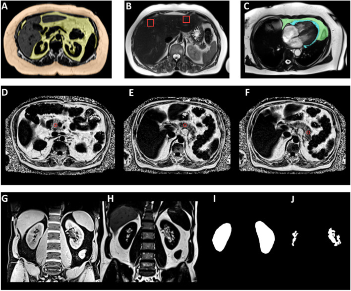 Fig. 2