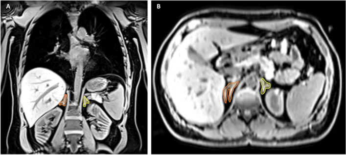 Fig. 1