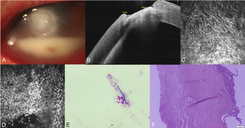 FIGURE1.