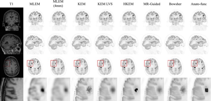 Figure 11