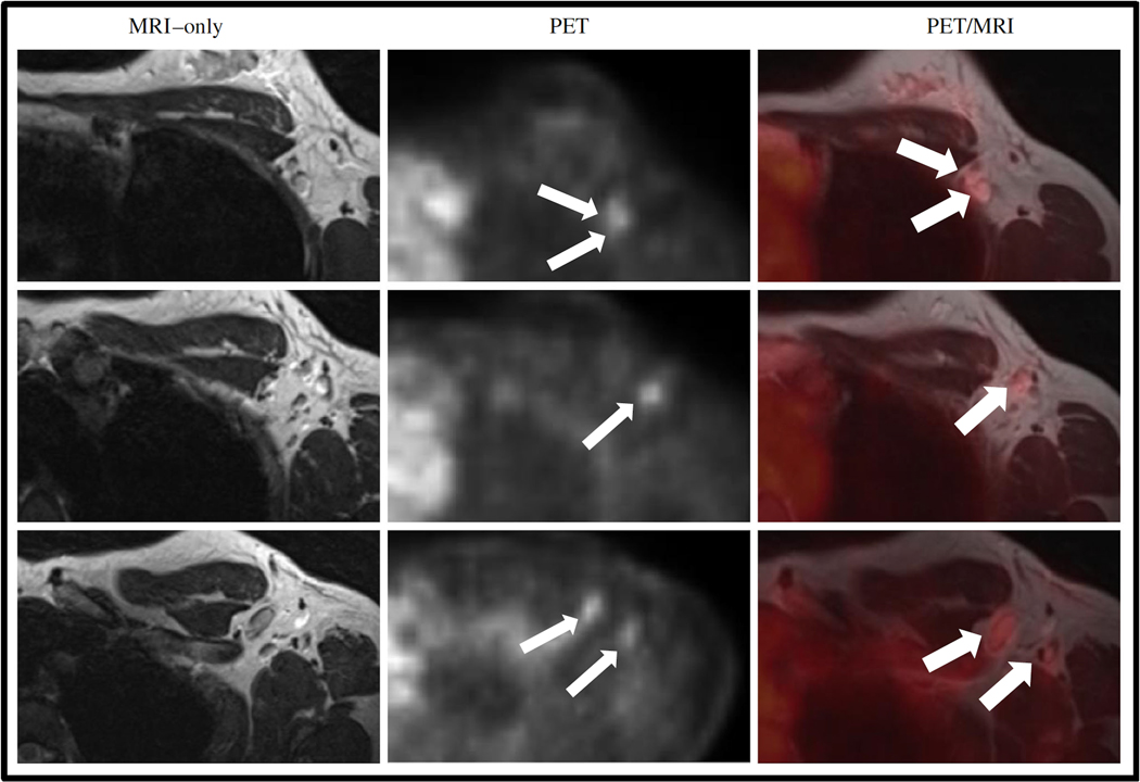 Figure 12.