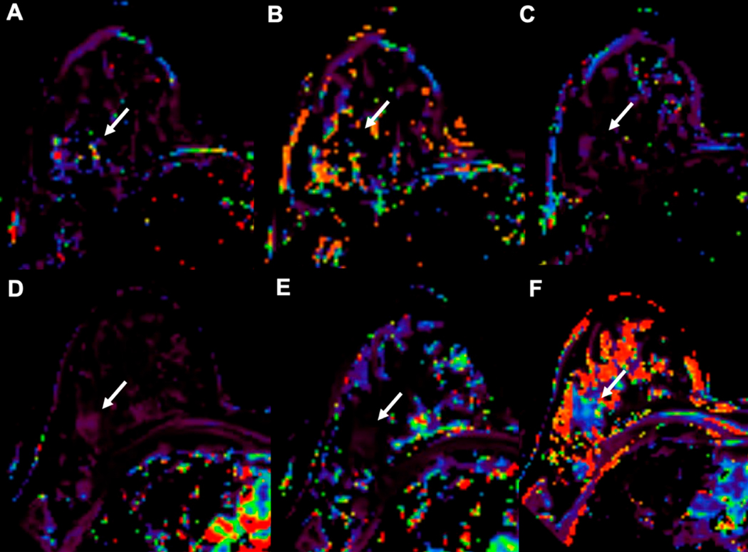 Figure 14.