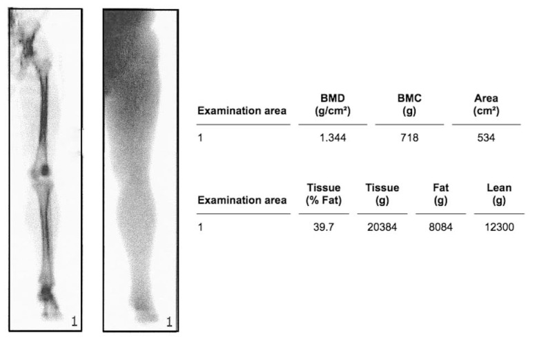 Fig. (1)