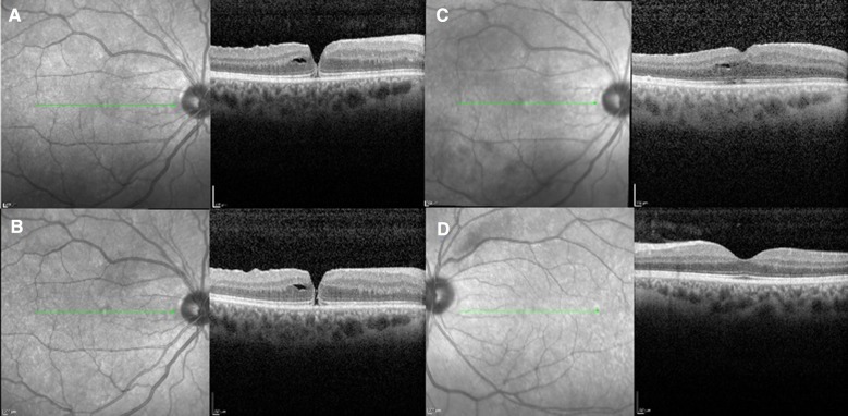 Fig. 1