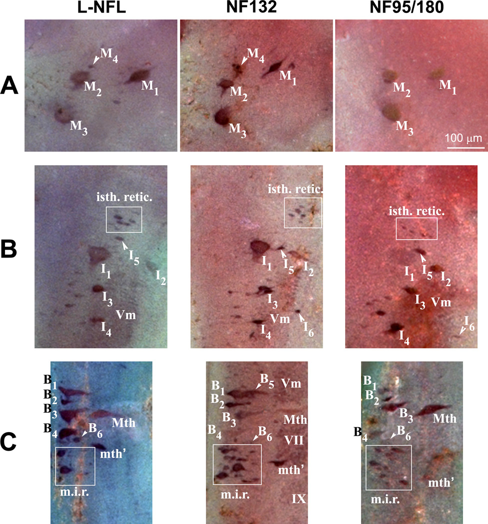 Figure 11