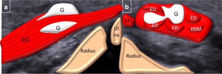 Fig. 2