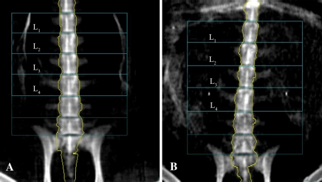 Fig. 1A–B