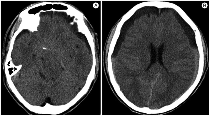 Fig. 5