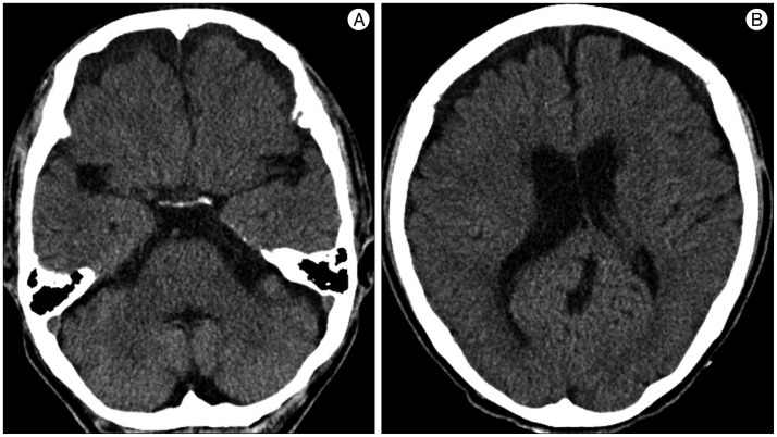 Fig. 7