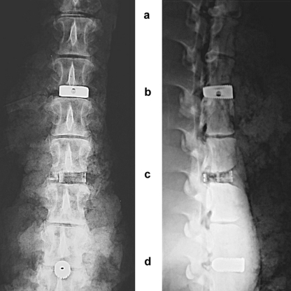 Fig. 2