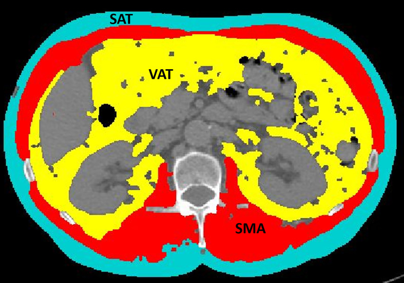 Figure 1