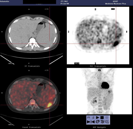 Fig. 4