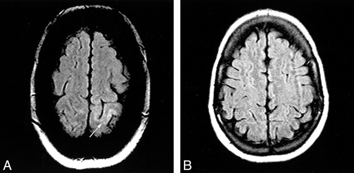 fig 2.