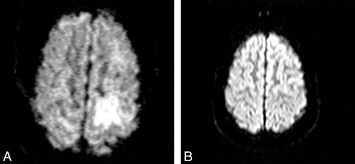 fig 3.