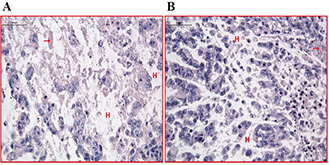 Fig. 11