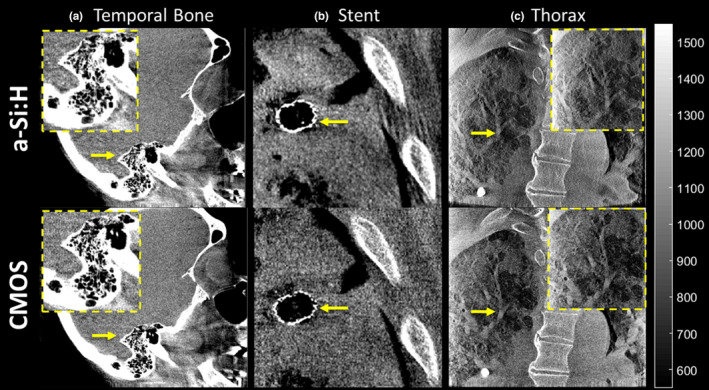 Figure 15