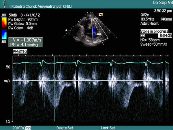 Figure 46