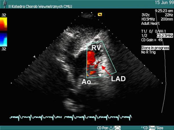 Figure 21