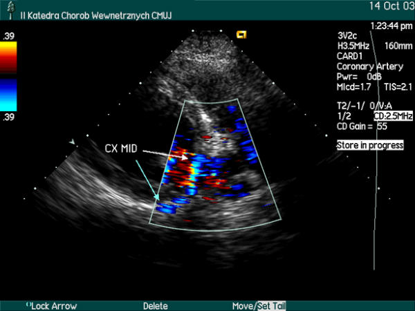 Figure 27