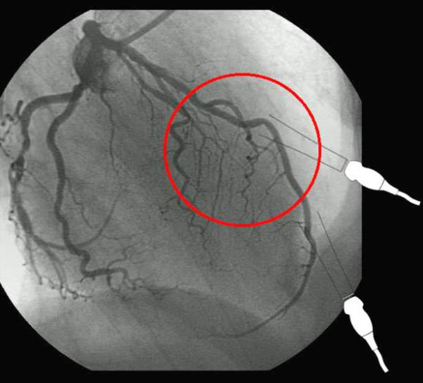 Figure 13