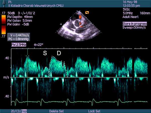 Figure 40