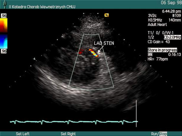 Figure 51