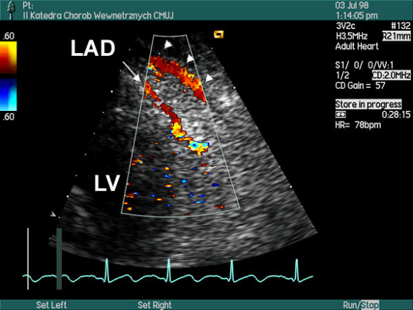 Figure 43