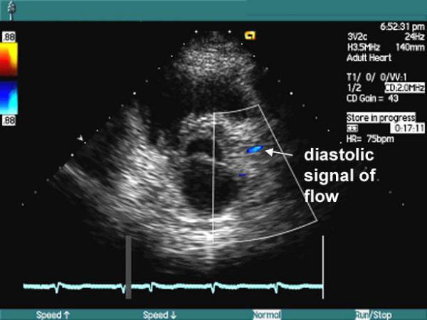 Figure 45