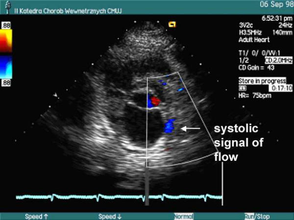 Figure 44