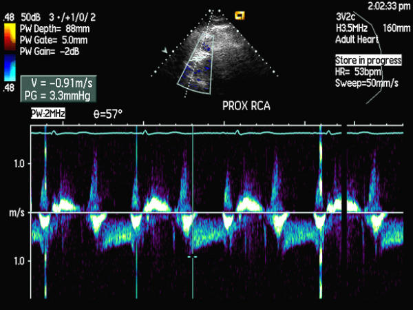 Figure 41