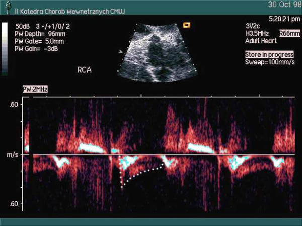 Figure 33